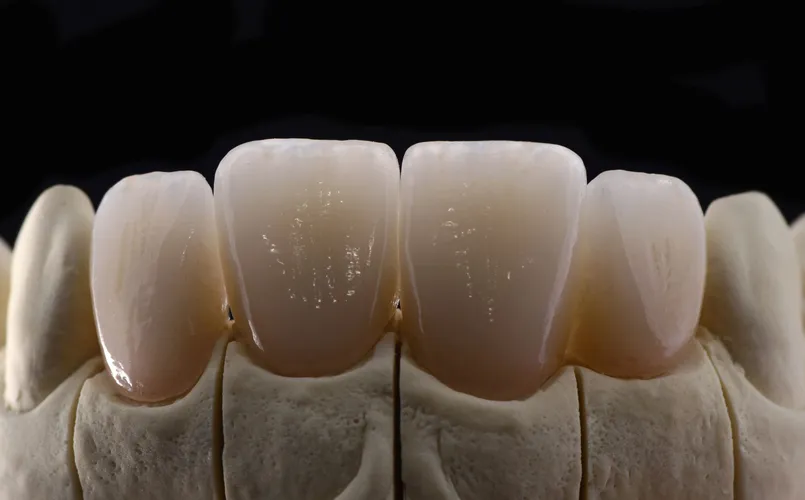 Ортопедическая стоматология | INTELLY