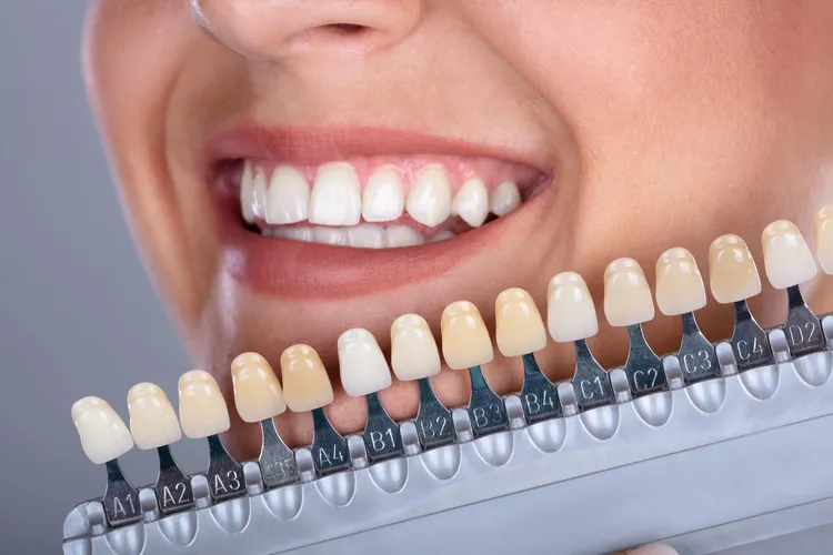 Эстетическое восстановление формы и цвета зубов | Стоматология в Томске | INTELLY | Эликсир Премьер