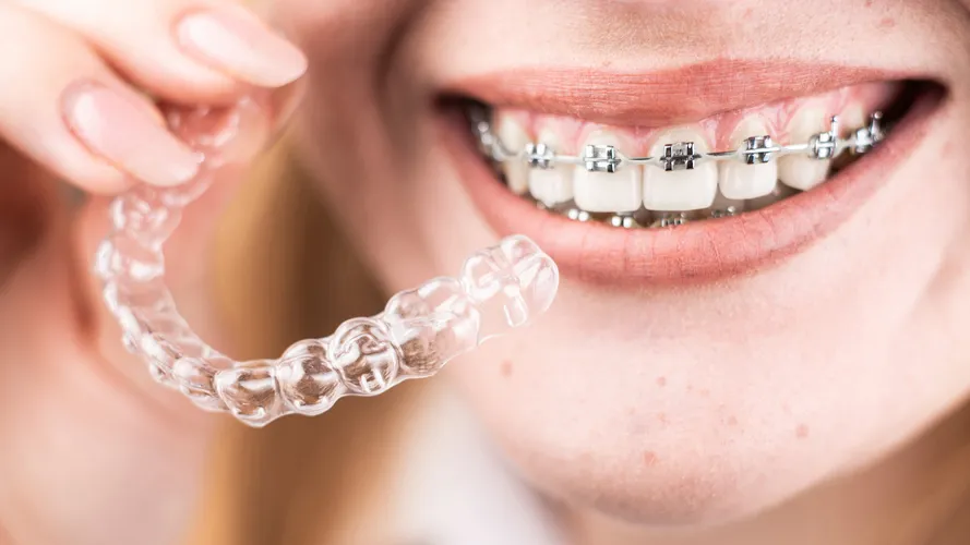 Ортодонтическая стоматология | INTELLY