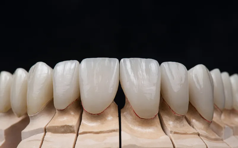 Коронки и зубные протезы из диоксида циркония | Стоматология в Томске | INTELLY | Эликсир Премьер