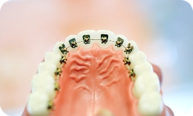 lingv